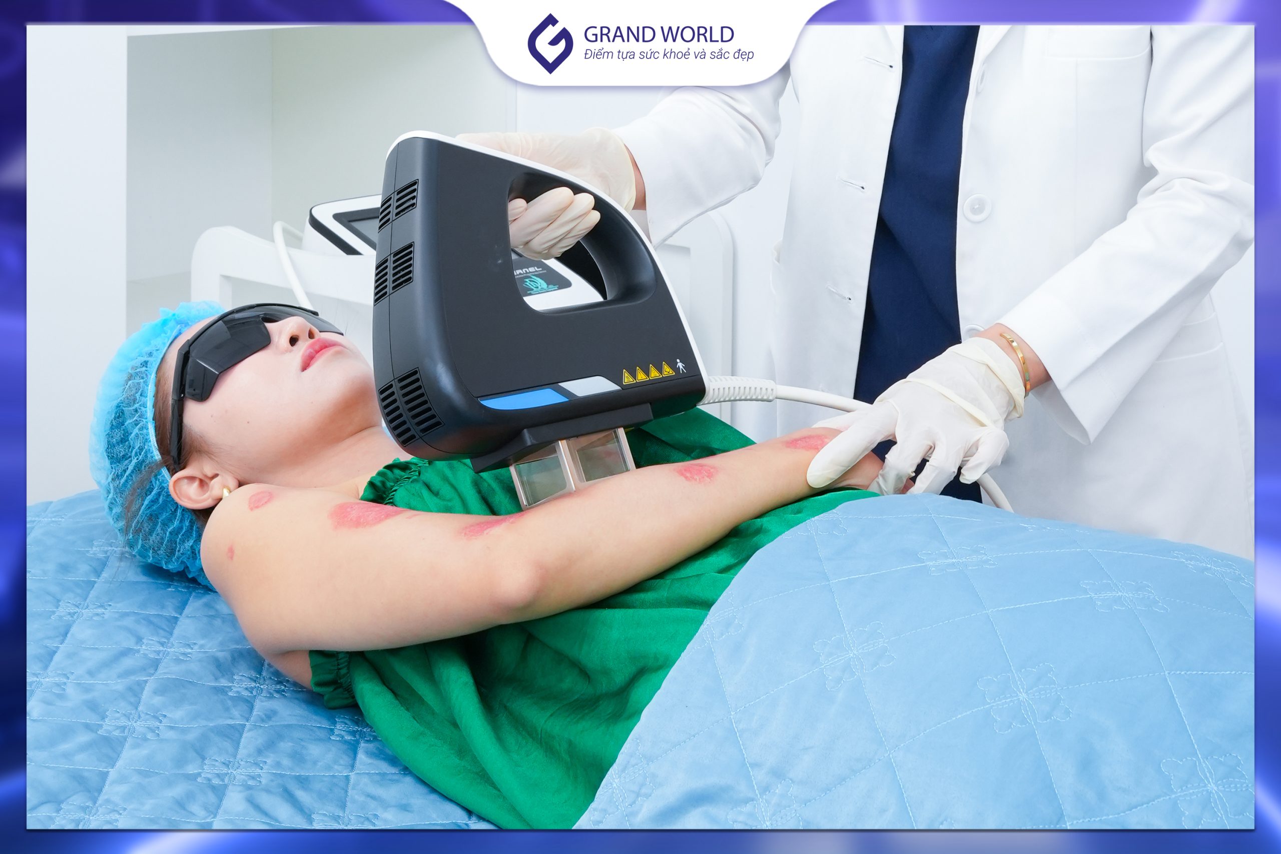 Quang trị liệu vảy nến