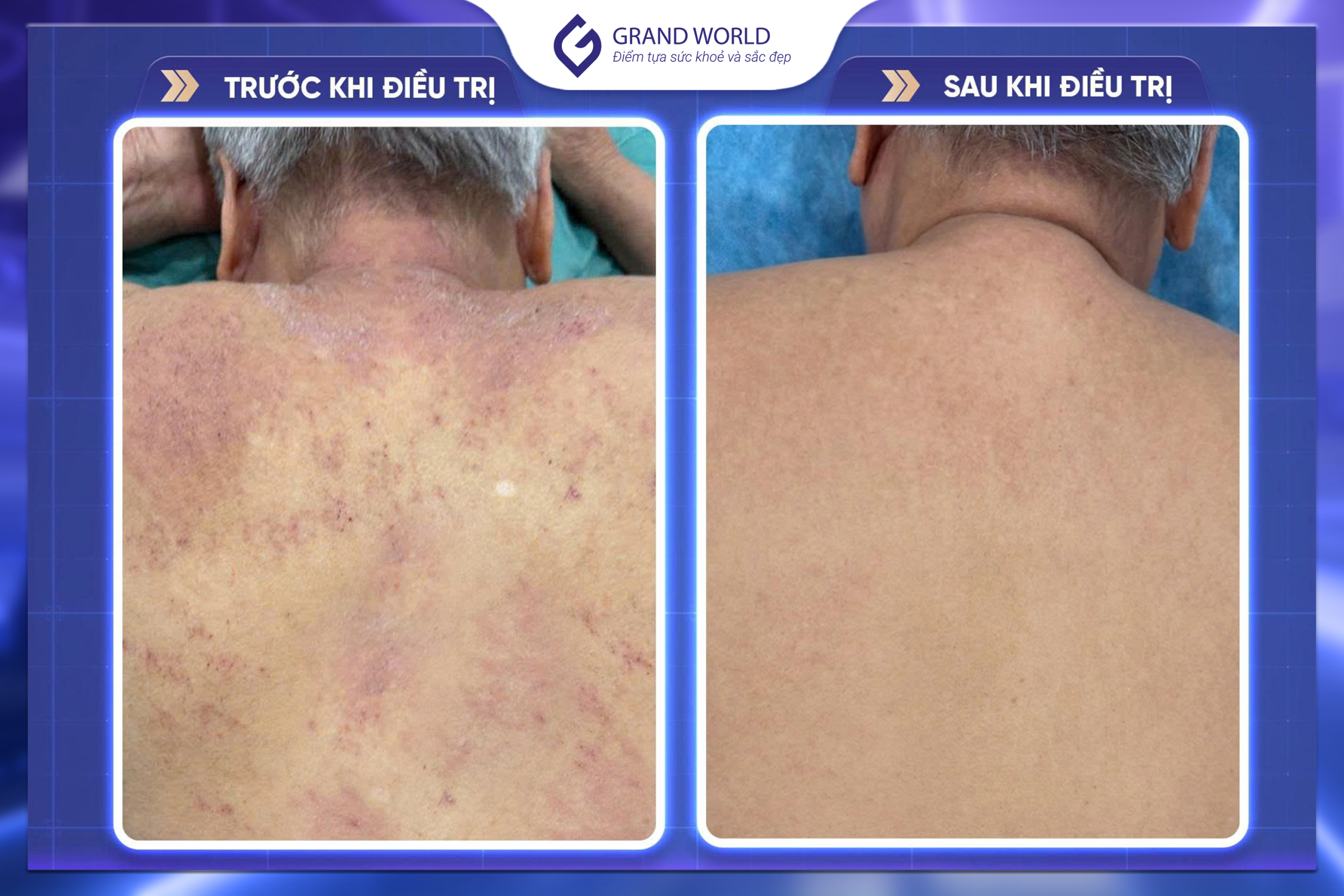 Hiệu quả trước và sau điều trị 2