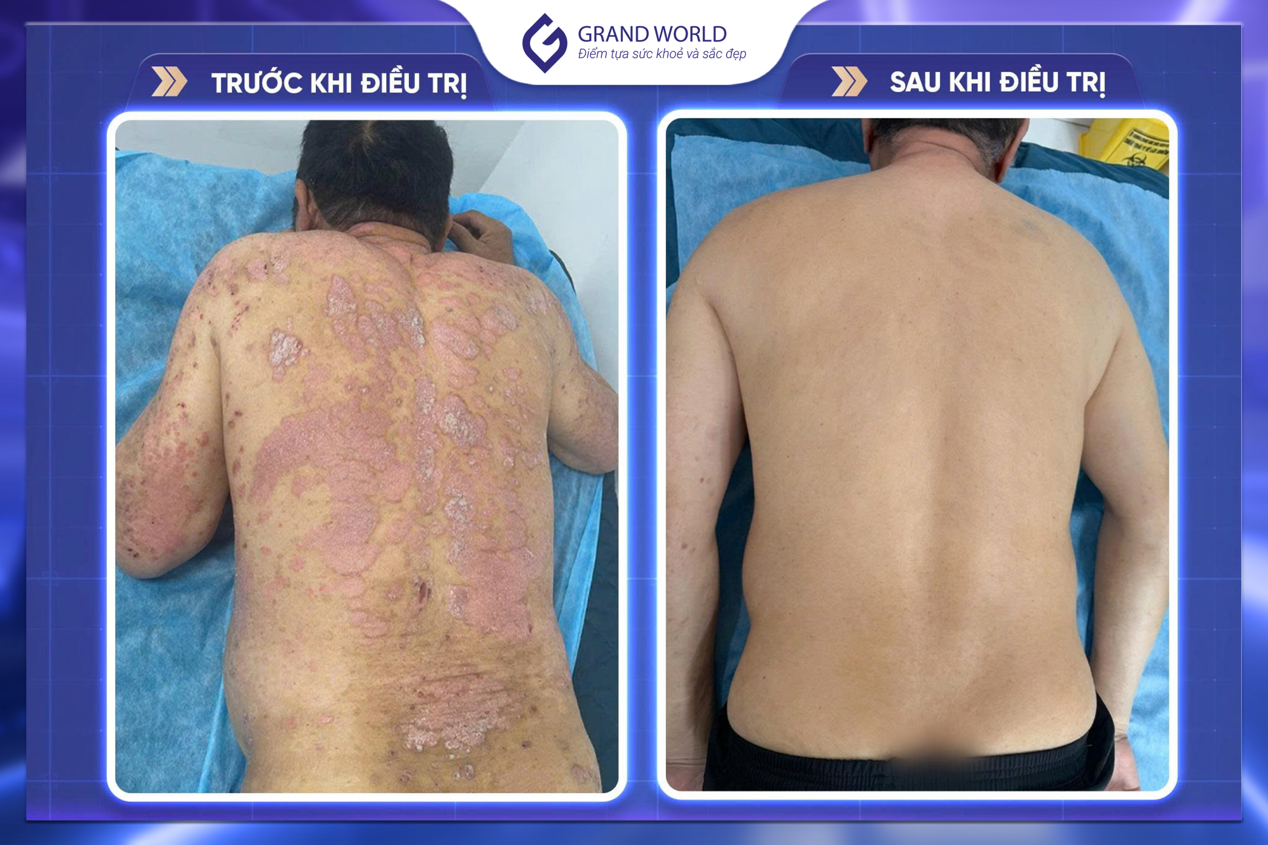 Hiệu quả trước và sau điều trị 1