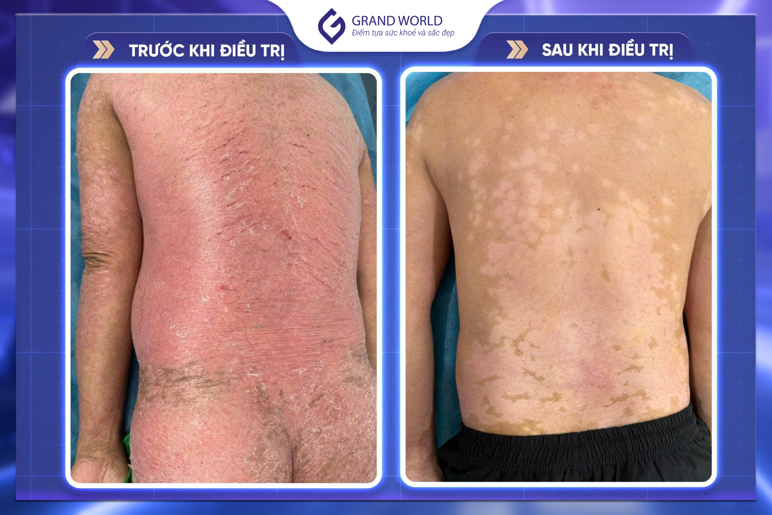 Hiệu quả trước và sau điều trị 2