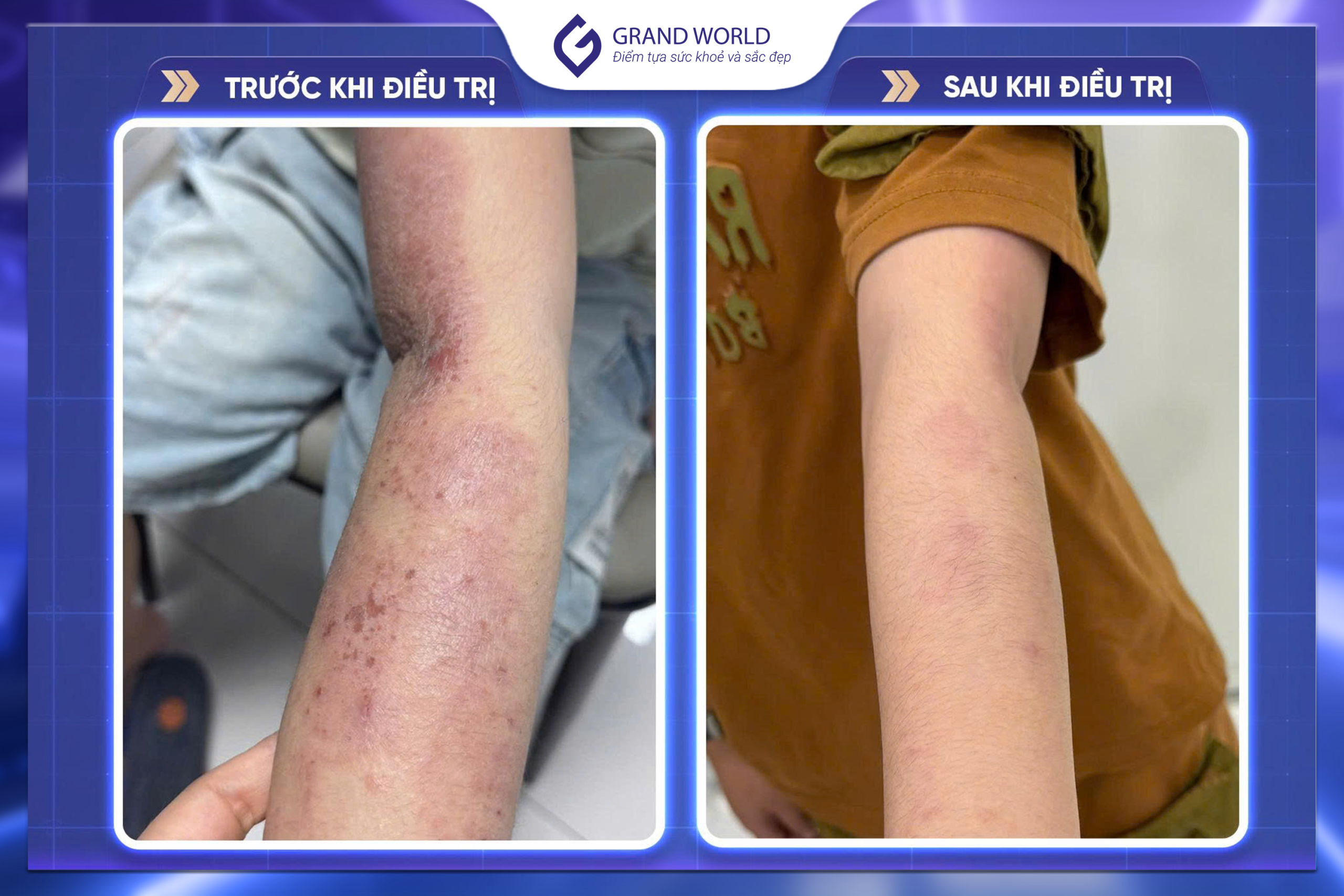 Hiệu quả trước và sau điều trị 3