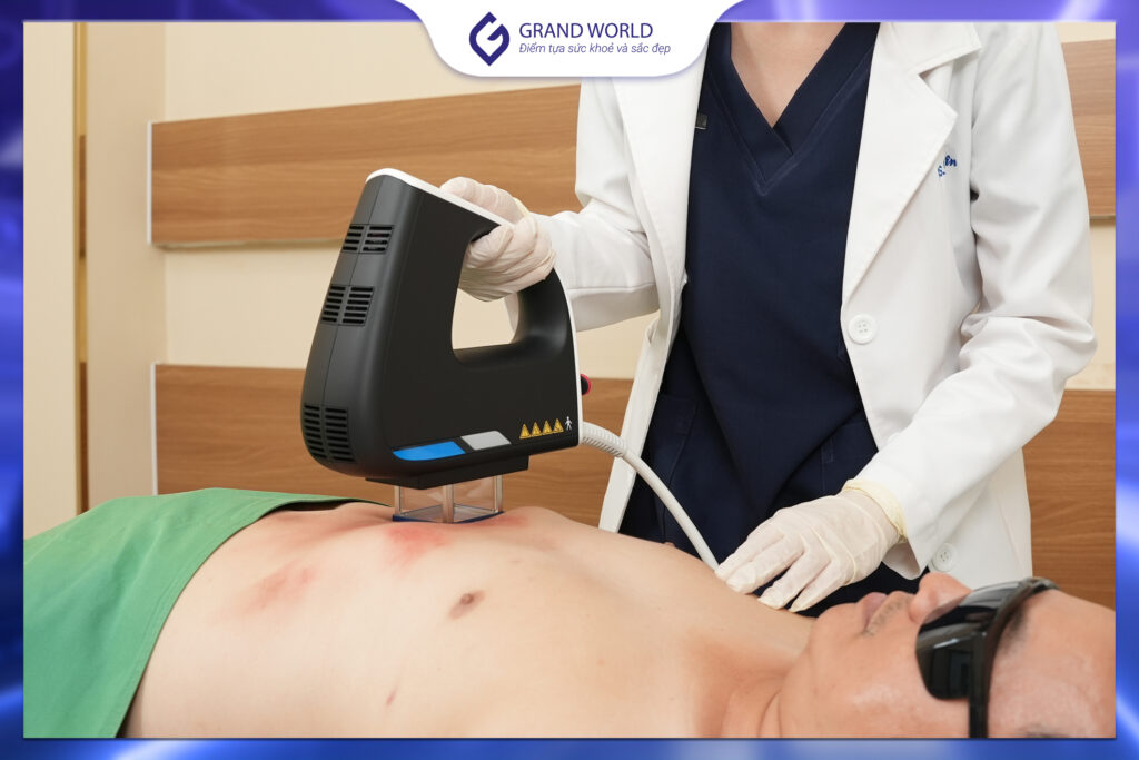 Điều trị vảy nến bằng thiết bị laser tại phòng khám, do bác sĩ chuyên khoa da liễu thực hiện