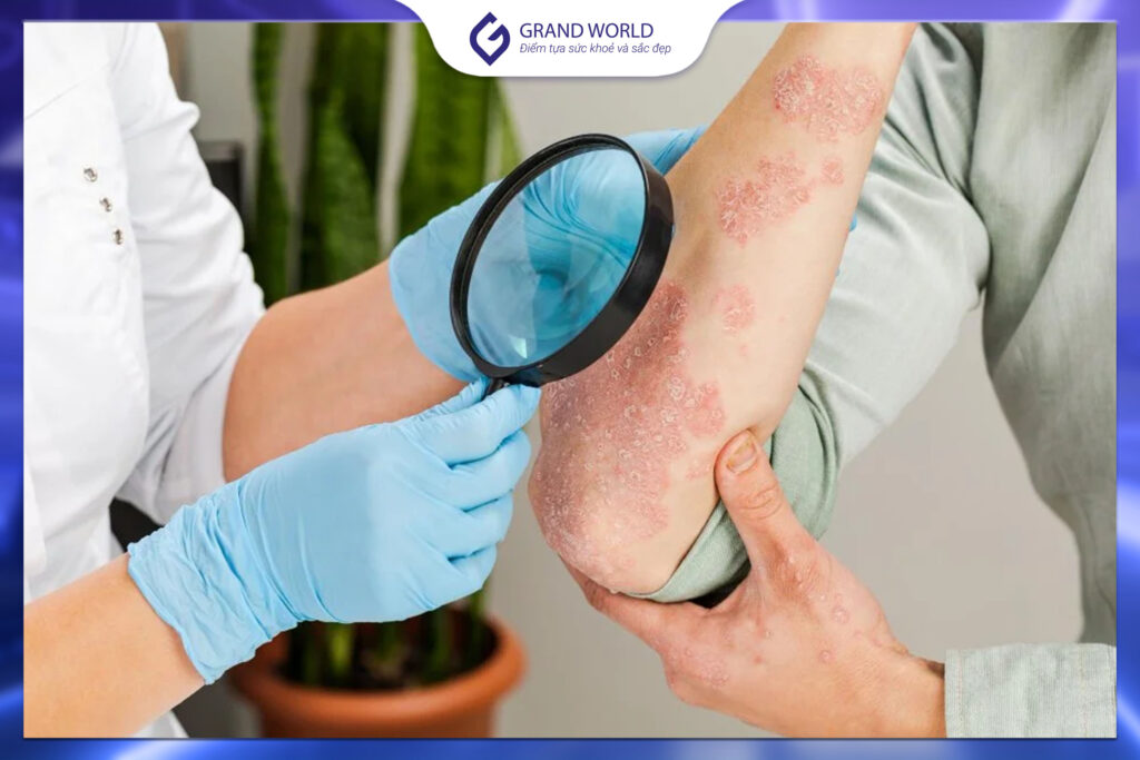 Bác sĩ đánh giá tổn thương da trước khi chỉ định corticoid phù hợp